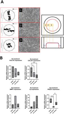 The modulating role of uniaxial straining in the IL-1β and TGF-β mediated inflammatory response of human primary ligamentocytes